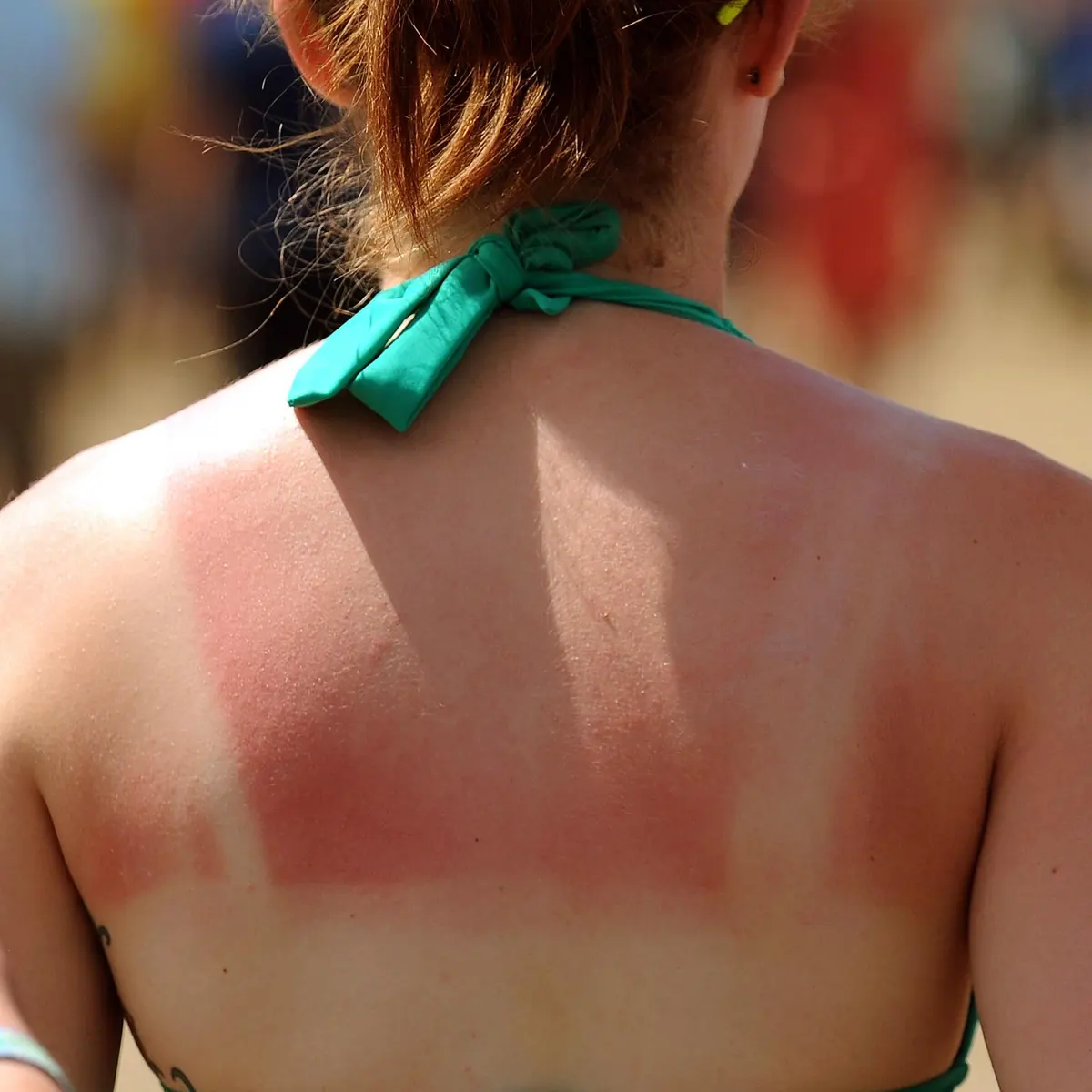 The Truth About Suntans: Debunking the Glow