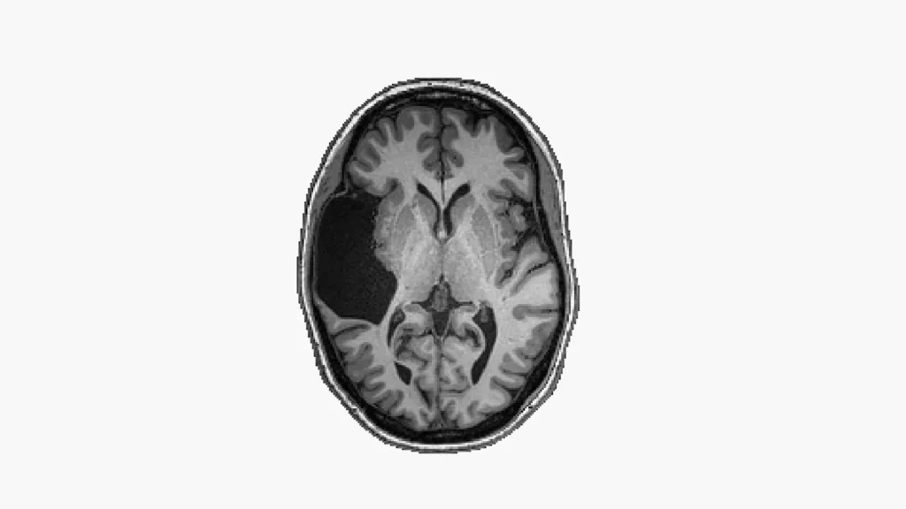 Elyse G.'s Brain