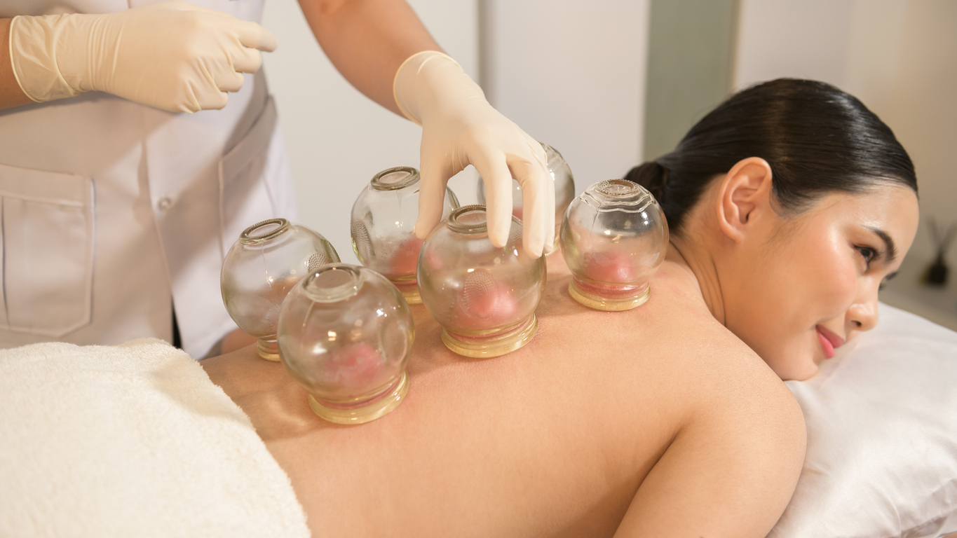 Beyond Bruises: 5 Ways Cupping Therapy Can Boost Your Physical and Mental Health by Dr. Mehmet Oz