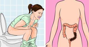 Diarrhea Causes