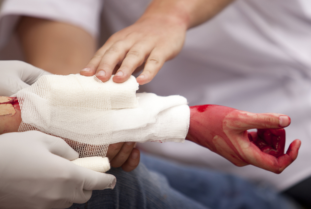 Wound Care Basics: Cleaning Injuries Safely and Effectively