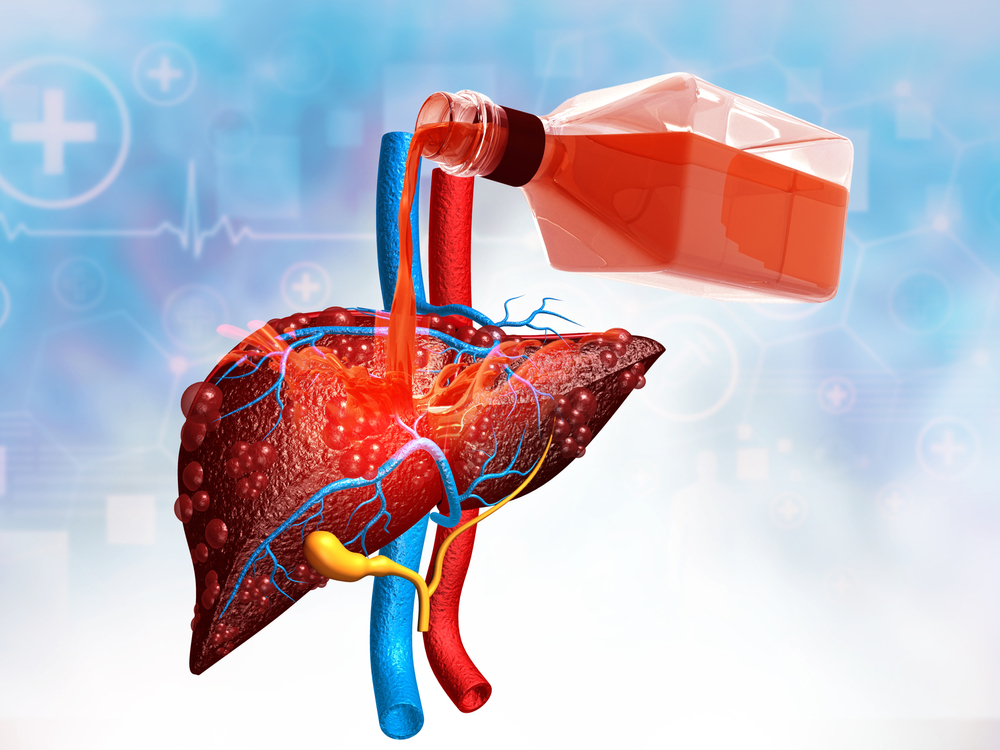 Alcohol and the Liver: Unveiling Alcoholic Hepatitis Risks and Protective Actions