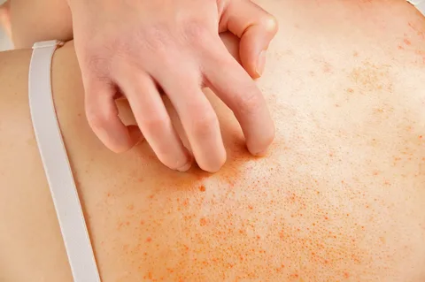Beyond the Rash: Recognizing Signs of a Problem