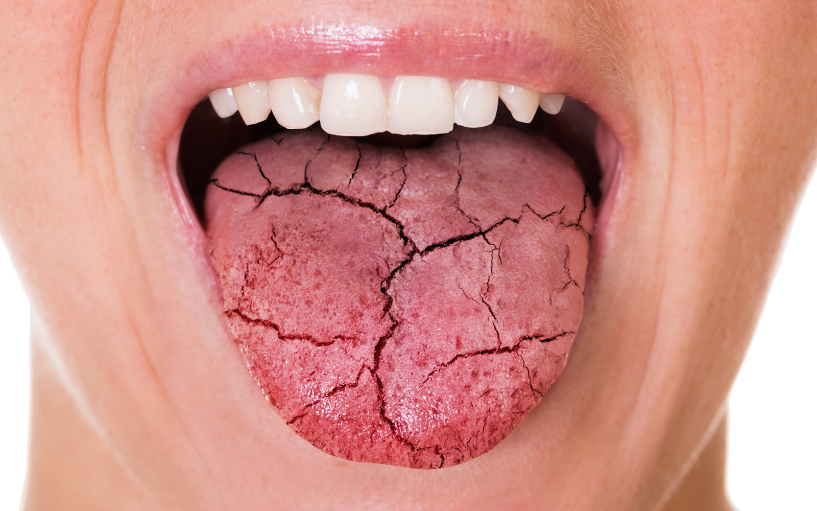 Easy Coping Tips for Common Mouth Problems