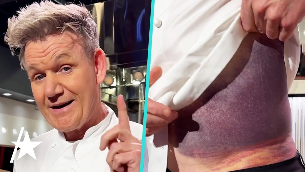 Gordon Ramsay's Bike Accident: A Candid Revelation of His Injuries
