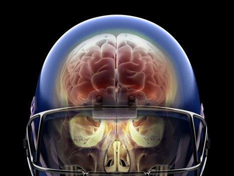 Link Between Concussions in Sports and Alzheimer's Risk